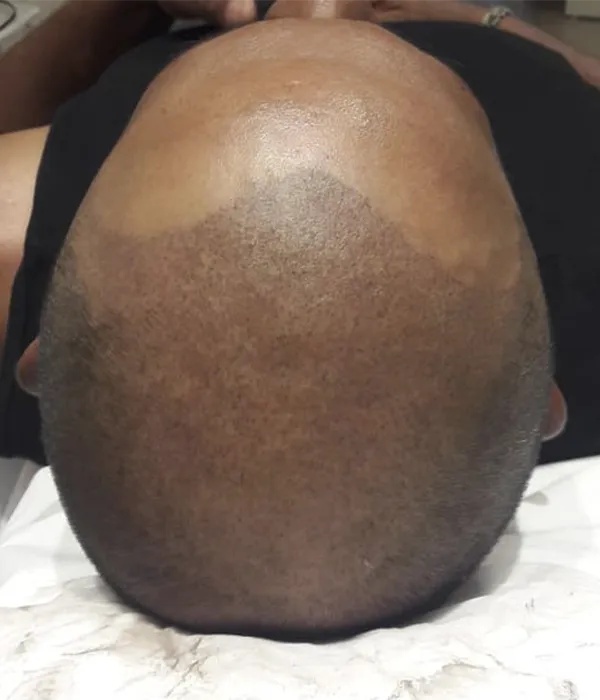 66